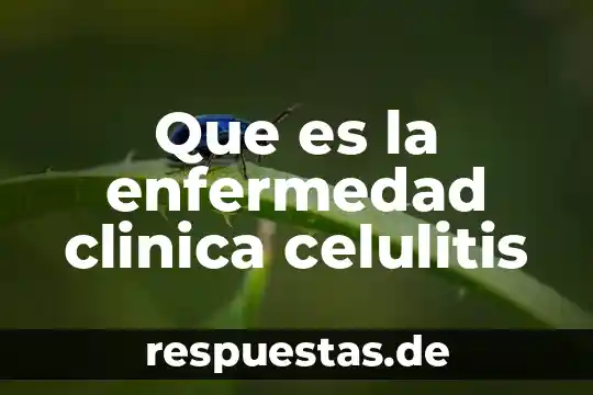 Que es una historia clinica para que sirve 4 Que es la enfermedad clinica celulitis